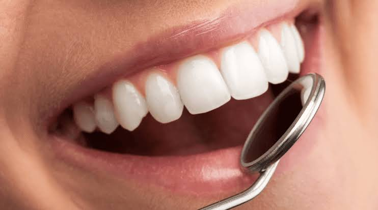 Reasons a Cosmetic Dentist London May Recommend Hygiene Care First